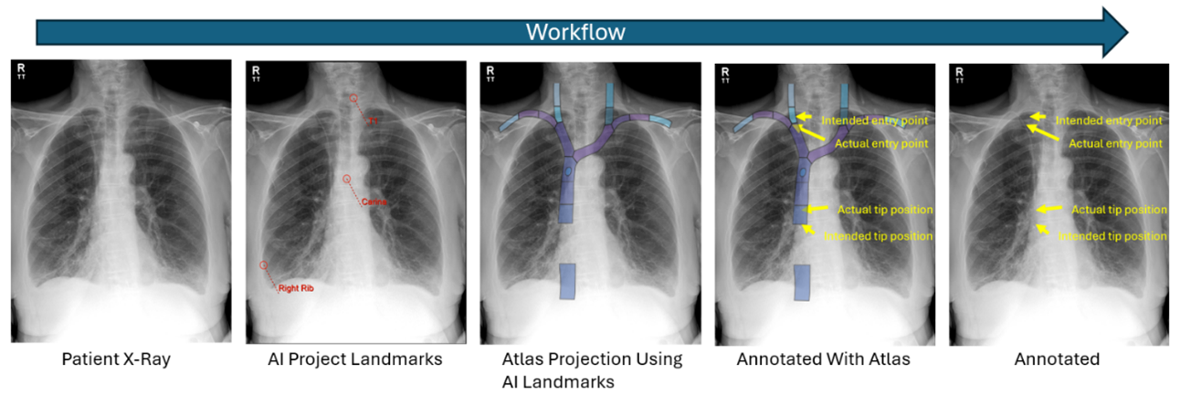 Image Adornment workflow